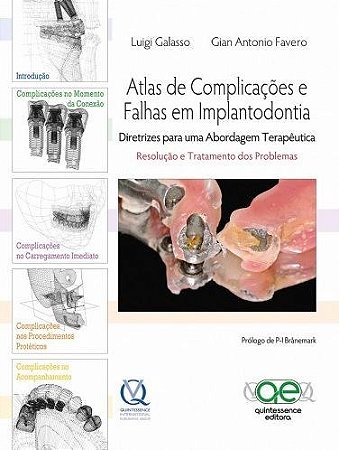 Livro Atlas de Complicações e Falhas em Implantodontia
