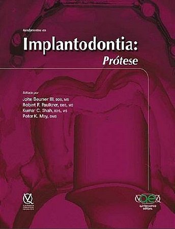Livro Fundamentos em Implantodontia: Protese - Beumer Iii
