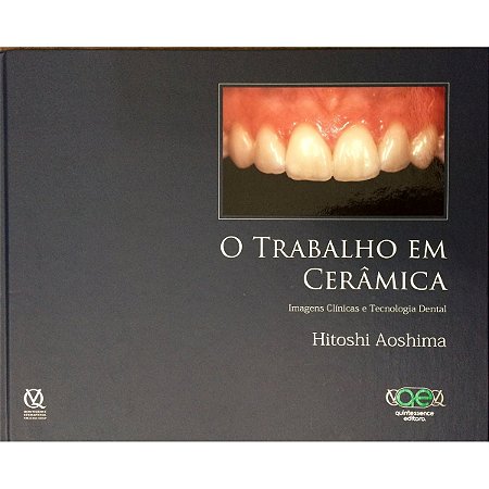 Livro Trabalho em Ceramica, o - Imagens Clinicas e Tecnologia Digital - Aoshima