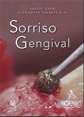 Livro Sorriso Gengival - Kahn - Santos Pub