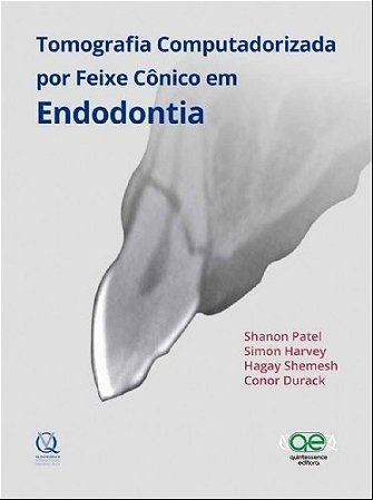 Livro Tomografia Computadorizada por Feixe Conico em Endodontia - Patel/harvey/shemesh