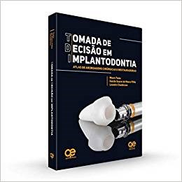 Livro Tomada de Decisao em Implantodontia Atlas de Abordagens Cirurgicas e Restau - Tosta/moura Filho/ch