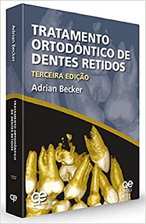 Livro Tratamento Ortodontico de Dentes Retidos - Becker