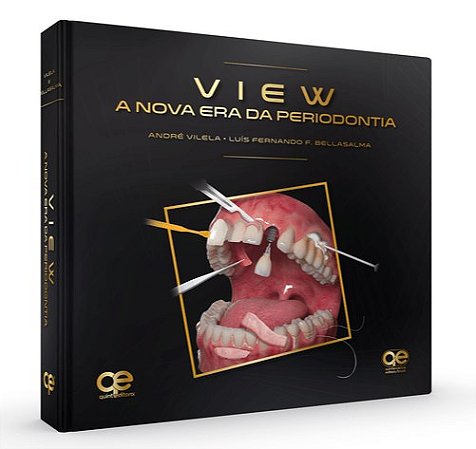 Livro View: a Nova era da Periodontia - Vilela/bellasalma