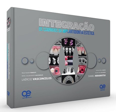 Livro Integracao: os Caminhos da Implantodontia Estetica - Vasconcelos/hiramats