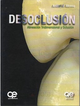 Livro Desoclusion Alineacion Tridimensional Y Oclusion (espanhol) - Alonso