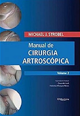 Manual de Cirurgia Artroscópica - Vol. 2 - Strobel - Dilivros
