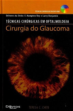 Cirurgia do Glaucoma - Chen - Dilivros