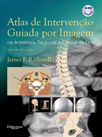 Livro Atlas de Intervenção Guiada por Imagem na Anestesia Regional e Clínica