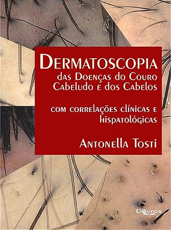 Livro Dermatoscopia das Doenças do Couro Cabeludo e dos Cabelos