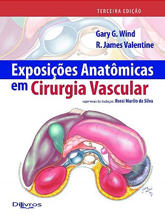 Exposições Anatômicas em Cirurgia Vascular - Wind - Dilivros
