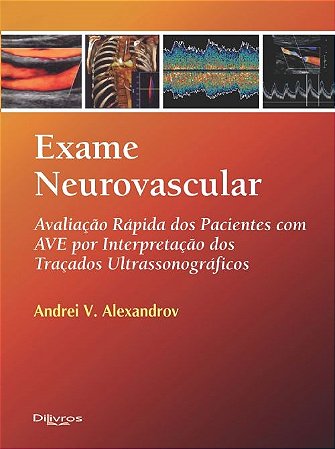 Livro Exame Neurovascular Avaliação Rápida dos Pacientes com Avc
