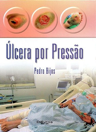 Livro Úlcera por Pressão *** Bijos