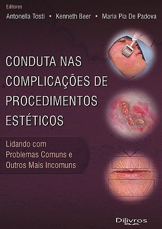 Livro Conduta Nas Complicações de Procedimentos Estéticos  Tosti