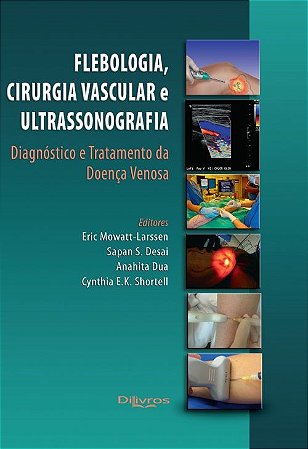 Flebologia, Cirurgia Vascular e Ultrassonografia: Diagnóstico e Tratamento - Larssen - Dilivros