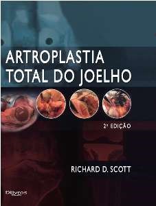 Livro Artroplastia Total do Joelho