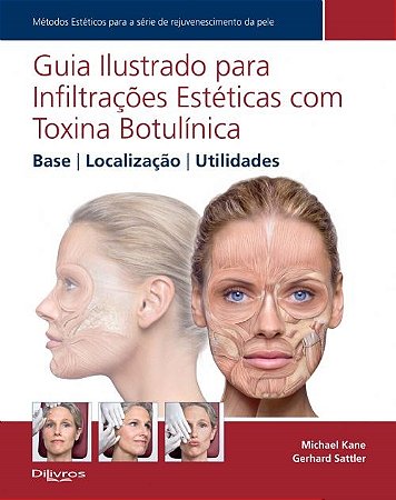 Livro Guia Ilustrado para Infiltrações Estéticas com Toxina Botulínica
