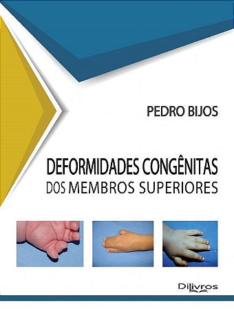 Livro Deformidades Congênitas dos Membros Superiores  Bijos