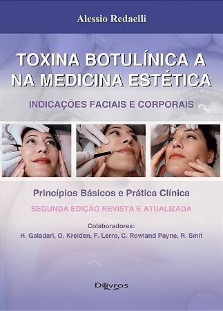 Livro Toxina Botulínica a na Medicina Estética Redaelli