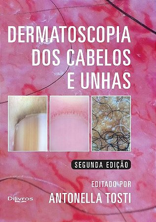 Livro Dermatoscopia dos Cabelos e Unhas