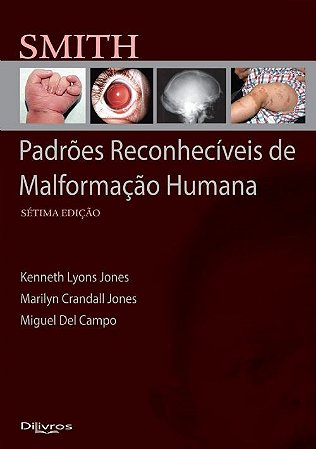 Livro Smith Padrões Reconhecíveis de Malformação Humana