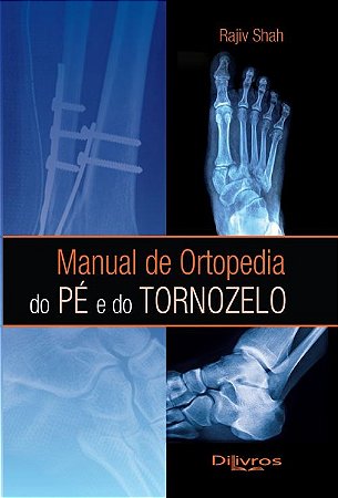 Livro Manual de Ortopedia do Pé e do Tornozelo