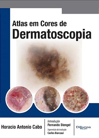 Livro Atlas em Cores de Dermatoscopia