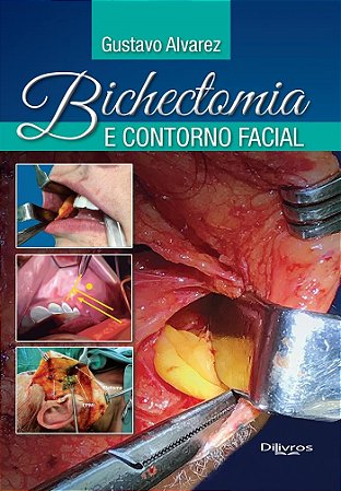 Livro Bichectomia e Contorno Facial  Alvarez