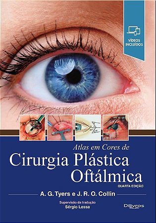 Livro Atlas em Cores de Cirurgia Plástica Oftálmica