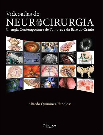 Livro Videoatlas de Neurocirurgia
