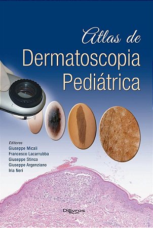 Livro Atlas de Dermatoscopia Pediátrica