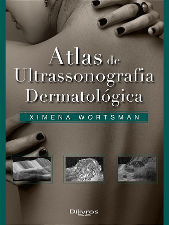 Livro Atlas de Ultrasonografia Dermatológica Wortsman