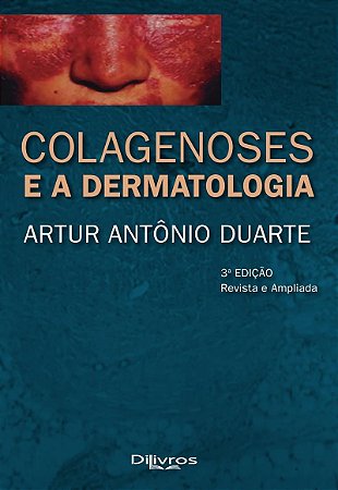 Livro Colagenoses e a Dermatologia Duarte