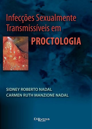 Infecções Sexualmente Transmissíveis em Proctologia - Nadal - Dilivros