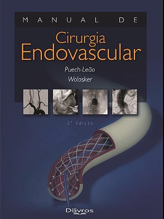 Manual de Cirurgia Endovascular - Wolosker - Dilivros
