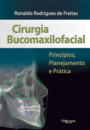 Livro Cirurgia Bucomaxilofacial  Freitas