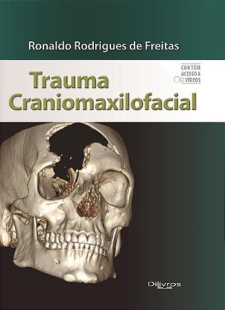 Livro Trauma Craniomaxilofacial  Marcus