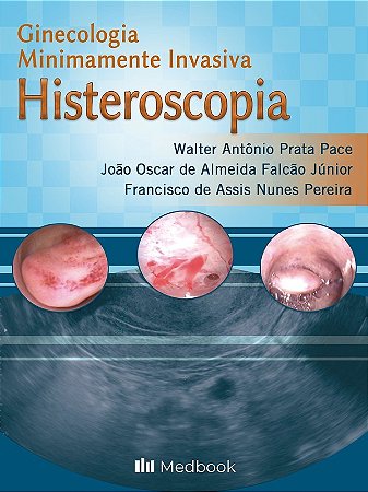 Livro Histeroscopia: Ginecologia Minimamente Invasiva  Pace