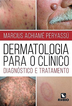 Livro Dermatologia para o Clinico: Diagnostico e Tratamento - Peryassu