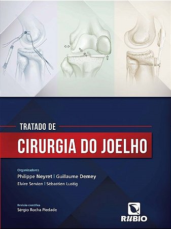 Livro Tratado de Cirurgia do Joelho