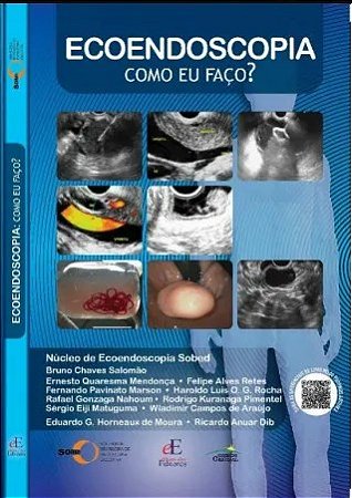 Livro Ecoendoscopia como Eu Faço