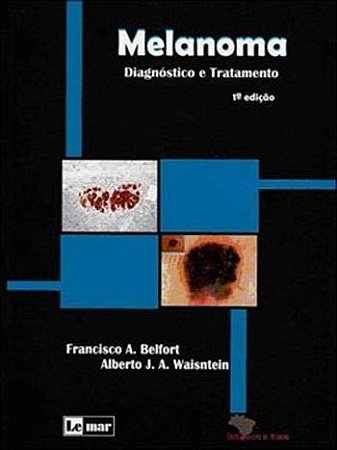 Livro Melanoma Diagnóstico e Tratamento - Belfort