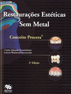 Livro Restauracoes Esteticas sem Metal - Francischone/vasconc