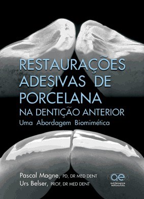 Livro Restauracoes Adesivas de Porcelana Na Denticao Anterior: Uma Abordagem Biom - Magne