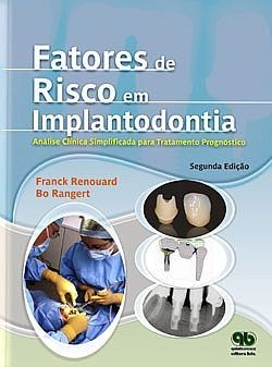 Livro Fatores de Risco em Implantodontia - Analise Clinica Simplificada para Um T - Renouard/ Rangert