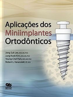 Livro Aplicacoes dos Miniimplantes Ortodonticos - Lee/kim/park/vanarsd