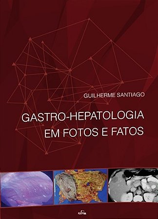 Livro Gastro-hepatologia em Fotos e Fatos
