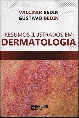 Livro Resumos Ilustrados em Dermatologia - Bedin