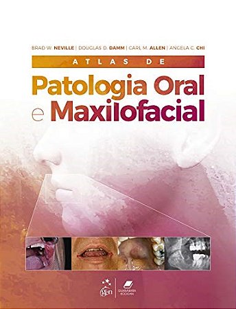 Livro Atlas de Patologia Oral e Maxilofacial Neville