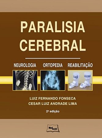 Livro Paralisia Cerebral Fonseca